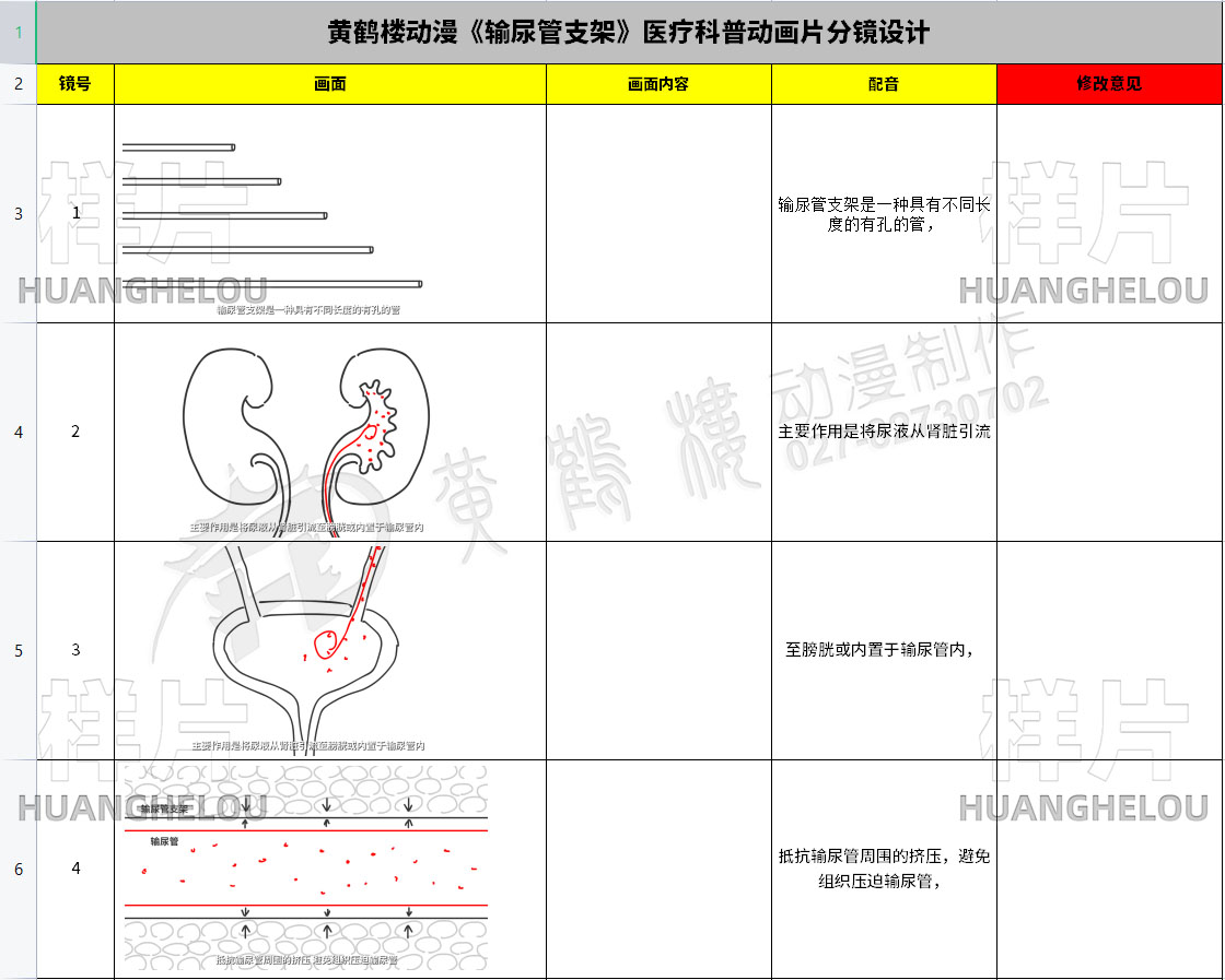 《输尿管支架》医疗科普动画片分镜设计1-4.jpg